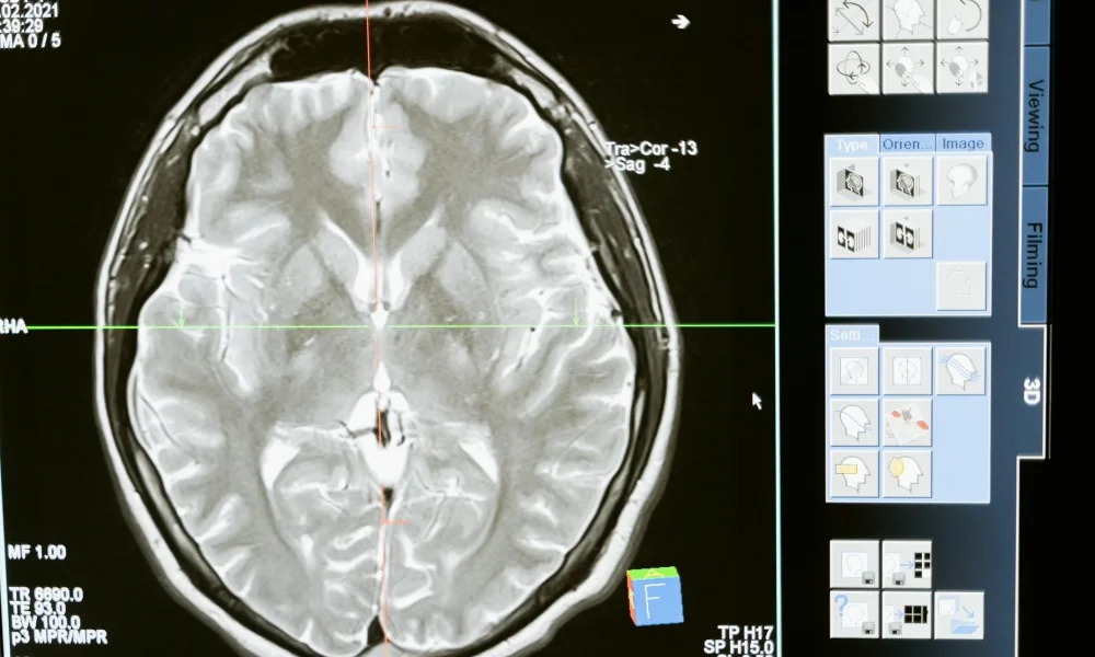 santral vertigo