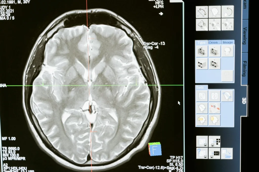 santral vertigo