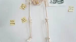 Vestibüler rehabilitasyon - hasta belirti gosterimi ve anatomik kesit illustrasyonu